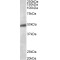 G Protein-Activated Inward Rectifier Potassium Channel 2 (KCNJ6) Antibody