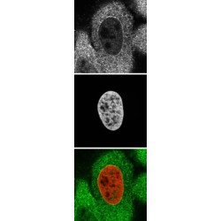 Importin Subunit Alpha-2 (KPNA2) Antibody