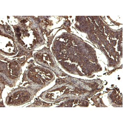 Karyopherin Alpha 3 (KPNA3) Antibody