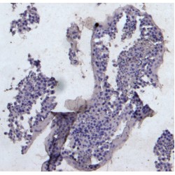 Karyopherin Alpha 3 (KPNA3) Antibody