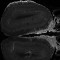 Neural Cell Adhesion Molecule 2 (NCAM2) Antibody