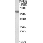 abx430376 (2 µg/ml) staining of Human Cerebellum (A), Mouse (B), and Rat (C) Brain lysate (35 µg protein in RIPA buffer). Primary incubation was 1 hour. Detected by chemiluminescence.