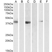 abx430380 (1 µg/ml) staining of U2OS (A) + peptide (B), (0.5 µg/ml) Jurkat (C) + peptide (D) and NIH3T3 (E) + peptide (F) cell lysate (35 µg protein in RIPA buffer). Detected by chemiluminescence.