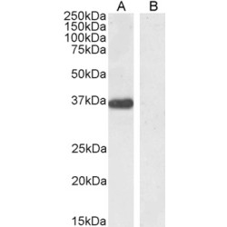 Pancreas Specific Transcription Factor 1a (PTF1A) Antibody