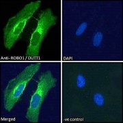 abx430381 Immunofluorescence analysis of paraformaldehyde fixed HeLa cells, permeabilized with 0.15% Triton. Primary incubation 1hr (10 µg/ml) followed by AF488 secondary antibody (2 µg/ml), showing Golgi and membrane staining. The nuclear stain is DAPI (blue). Negative control: Unimmunized goat IgG (10 µg/ml) followed by AF488 secondary antibody (2 µg/ml).