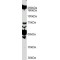 Roundabout Guidance Receptor 1 (ROBO1) Antibody