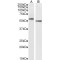 Synaptic Vesicular Amine Transporter (SLC18A2) Antibody