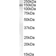 abx430390 (0.5 µg/ml) staining of HeLa cell nuclear lysate (35 µg protein in RIPA buffer). Primary incubation was 1 hour. Detected by chemiluminescence.