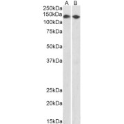 abx430395 (0.5 µg/ml) staining of HEK293 (A) and MCF7 (B) nuclear lysates (35 µg protein in RIPA buffer). Primary incubation was 1 hour. Detected by chemiluminescence.