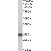 abx430397 (0.5 µg/ml) staining of Rat Brain lysate (35 µg protein in RIPA buffer). Primary incubation was 1 hour. Detected by chemiluminescence.