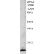 abx430403 staining (2 µg/ml) of Jurkat lysate (RIPA buffer, 30 µg total protein per lane). Primary incubated for 1 hour. Detected by western blot using chemiluminescence.