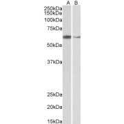 abx430405 (2 µg/ml) staining of Hela (A) and K562 (B) nuclear lysates (35 µg protein in RIPA buffer). Detected by chemiluminescence.