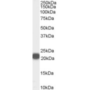 abx430408 (0.01 µg/ml) staining of Human Prostate lysate (35 µg protein in RIPA buffer). Primary incubation was 1 hour. Detected by chemiluminescence.