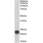 Biotinylated abx430408 (0.1 µg/ml) staining of Human Cerebellum lysate (35 µg protein in RIPA buffer), exactly mirroring its parental non-biotinylated product. Primary incubation was 1 hour. Detected by chemiluminescence, using streptavidin-HRP and using NAP blocker as a substitute for skimmed milk.