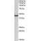 Potassium Inwardly Rectifying Channel Subfamily J, Member 1 (KCNJ1) Antibody