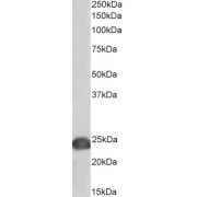 Biotinylated abx430436 (0.2 µg/ml) staining of Jurkat lysate (35 µg protein in RIPA buffer), exactly mirroring its parental non-biotinylated product. Primary incubation was 1 hour. Detected by chemiluminescence, using streptavidin-HRP and using NAP blocker as a substitute for skimmed milk.