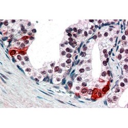 BRG1-Associated Factor 57 (BAF57) Antibody