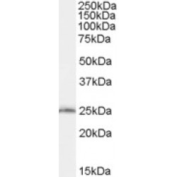 GTP-Binding Protein SAR1b (SAR1B) Antibody