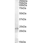 abx430445 (0.01 µg/ml) staining of Jurkat cell lysate (35 µg protein in RIPA buffer). Primary incubation was 1 hour. Detected by chemiluminescence.