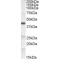 Lipid Droplet-Binding Protein CGI-58 (CGI58) Antibody