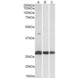 Dual Specificity Phosphatase 6 (DUSP6) Antibody