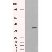 HEK293 overexpressing GIPC1 isoform 1 and probed with abx430451 (mock transfection in first lane).