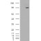 SMEK Homolog 1 (SMEK1) Antibody