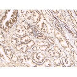 Tumor Suppressor Candidate 3 (TUSC3) Antibody