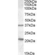 abx430464 (1 µg/ml) staining of Human Liver lysate (35 µg protein in RIPA buffer). Primary incubation was 1 hour. Detected by chemiluminescence.