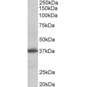 abx430476 (0.1 µg/ml) staining of Human Lymph Node lysate (35 µg protein in RIPA buffer). Primary incubation was 1 hour. Detected by chemiluminescence.