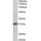 Aminoacyl tRNA Synthetase Complex Interacting Multifunctional Protein 1 (AIMP1) Antibody