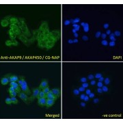 abx430479 Immunofluorescence analysis of paraformaldehyde fixed A431 cells, permeabilized with 0.15% Triton. Primary incubation 1hr (10 µg/ml) followed by AF488 secondary antibody (4 µg/ml), showing cytoplasmic and Golgi apparatus staining. The nuclear stain is DAPI (blue). Negative control: Unimmunized goat IgG (10 µg/ml) followed by AF488 secondary antibody (4 µg/ml).