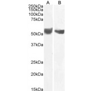 abx430486 (0.1 µg/ml) staining of Human Placenta (A) and (2 µg/ml) Testes (B) lysate (35 µg protein in RIPA buffer). Primary incubation was 1 hour. Detected by chemiluminescence.