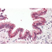 abx430487 (3.75 µg/ml staining of paraffin embedded Human Lung. Steamed antigen retrieval with citrate buffer pH 6, AP-staining.