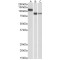 Cadherin-13 (CDH13) Antibody