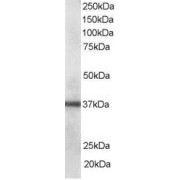abx430500 staining (0.1 µg/ml) of Human Lung lysate (RIPA buffer, 35 µg total protein per lane). Primary incubated for 1 hour. Detected by chemiluminescence.