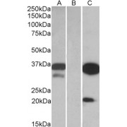 HEK293 lysate (10 µg protein in RIPA buffer) over expressing Human DAPP1 with DYKDDDDK tag probed with abx430505 (0.1 µg/ml) in Lane A and probed with anti- DYKDDDDK Tag (1/3000) in lane C. Mock-transfected HEK293 probed with abx430505 (1mg/ml) in Lane B. Primary incubations were for 1 hour. Detected by chemiluminescence.
