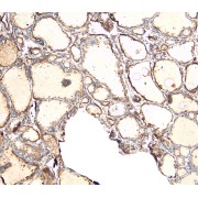 Immunohistochemistry analysis of paraffin-embedded Human Thyroid Gland using Ectonucleotide Pyrophosphatase/Phosphodiesterase 1 (ENPP1) Antibody (4 µg/ml). Heat induced antigen retrieval with citrate buffer pH 6, HRP-staining.