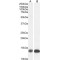 Fatty Acid Binding Protein 1, Liver (FABP1) Antibody
