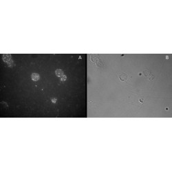 Forkhead Box Protein P3 (FOXP3) Antibody