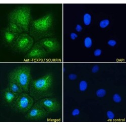 Forkhead Box Protein P3 (FOXP3) Antibody