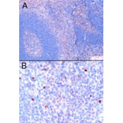 Forkhead Box Protein P3 (FOXP3) Antibody