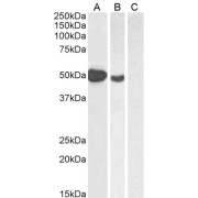 abx430531 (1 µg/ml) staining of Human Muscle (A), (2 µg/ml) MOLT4 (B) and (1 µg/ml) negative control Pancreas (C) lysate (35 µg protein in RIPA buffer). Detected by chemiluminescence.