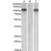 HEK293 lysate (10 µg protein in RIPA buffer) overexpressing Human Furin with C-terminal MYC tag probed with abx430533 (1 µg/ml) in Lane A and probed with anti-MYC Tag (1/1000) in lane C. Mock-transfected HEK293 probed with abx430533 (1 µg/ml) in Lane B. Primary incubations were for 1 hour. Detected by chemiluminescence.