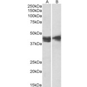 abx430549 (2 µg/ml) staining of Jurkat (A) and Molt4 (B) lysates (35 µg protein in RIPA buffer). Detected by chemiluminescence.