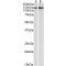 Integrin Alpha 1 (ITGA1) Antibody