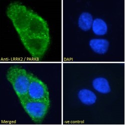 Leucine-Rich Repeat Serine/Threonine-Protein Kinase 2 (LRRK2) Antibody