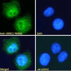 Leucine-Rich Repeat Serine/Threonine-Protein Kinase 2 (LRRK2) Antibody