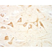 IHC-P analysis of Human Hippocampus CA4 using abx430559 (1.5 µg/ml). Microwaved antigen retrieval with citrate buffer pH 6, HRP-staining.