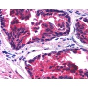 abx430605 1.25 µg/ml staining of paraffin embedded human prostate. Steamed antigen retrieval with citrate buffer pH 6, AP-staining.